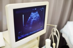 Początek historii badania ultrasonograficznego